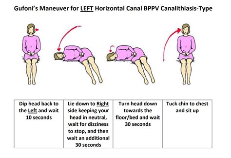 Epley Maneuver Epley Maneuver For Right Sided Posterior Semicircular Todd Kinesen