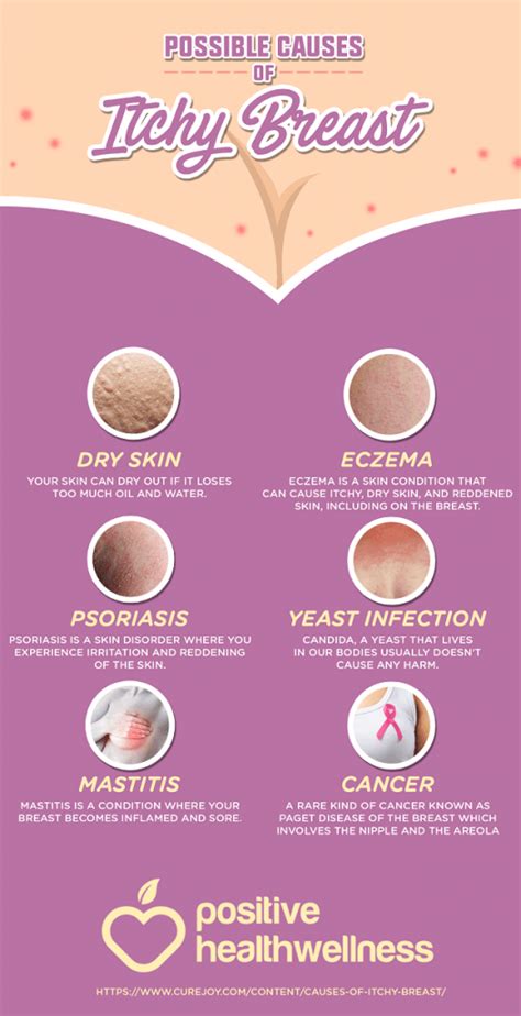 Possible Causes Of Itchy Breasts Infographic Positive Health Wellness