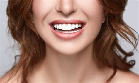 Dental Veneers Your Chances To Get A Flaw Less Smile Dentist Office