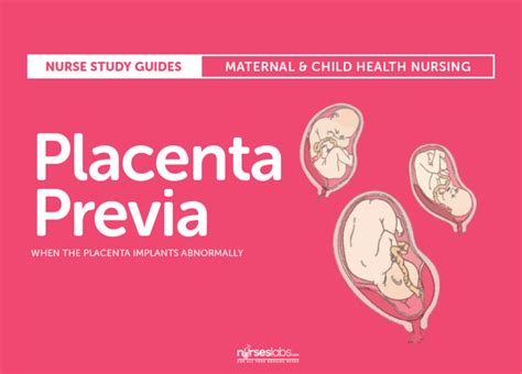 Placenta Previa Nursing Care Plan And Management