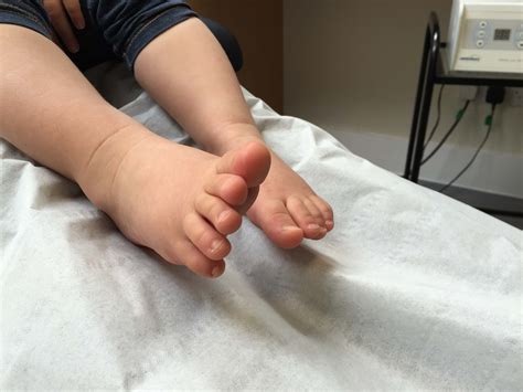 Childrens Feet Fitter Feet For Lifefitter Feet For Life