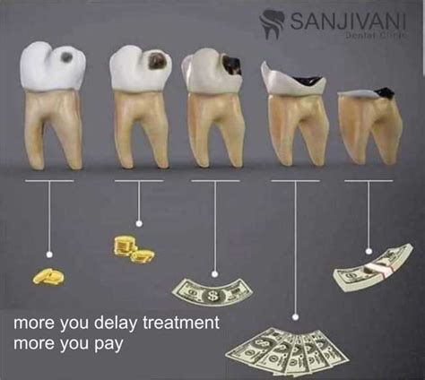 Why Dental Treatment Is Costly Sanjivani Dental Hospital