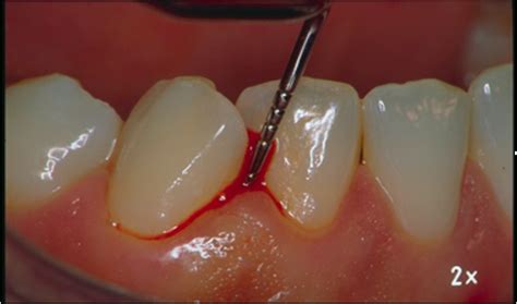 Periodontology Manchester Dental Students Society
