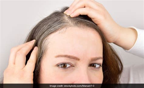 5 causes of premature greying of hair