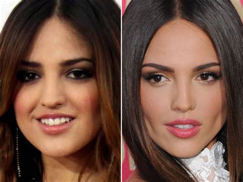 Eiza González Before And After The Skincare Edit