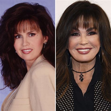 Has Marie Osmond Gotten Plastic Surgery Our Experts Weigh In