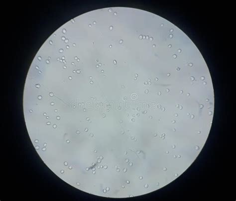 Yeast Under The Microscope Stock Image Image Of Microscopic 26710125
