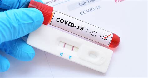 Covid 19 Antibody Testing Mydoc Urgent Care