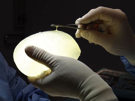 Woman Who Tripped And Ruptured Breast Implant Wins 85 000 From San Diego In Damages The