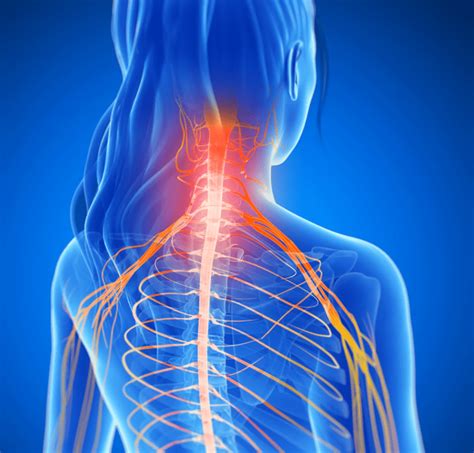 If You Have A Pinched Nerve In Your Neck Read On