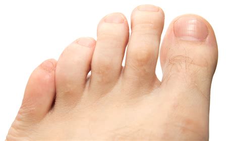 Close Up Of Hairy Toes On Foot Rnvpodiatry