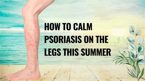 How To Calm Psoriasis On The Legs This Summer Hanna Sillitoe