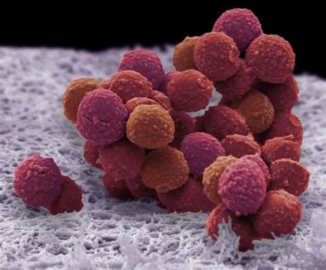 Staphylococcus Epidermidis Bacteria Photograph By Steve Gschmeissner
