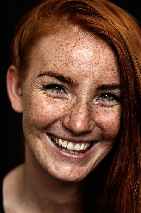98 Freckled People Wholl Hypnotize You With Their Unique Beauty