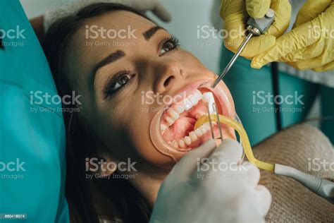 Young Woman Holding Her Mouth Opened During Dental Procedure Stock