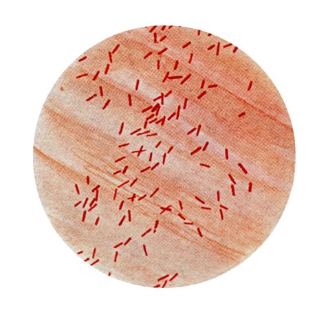 Free Picture Photomicrograph Escherichia Coli Bacillus Coli