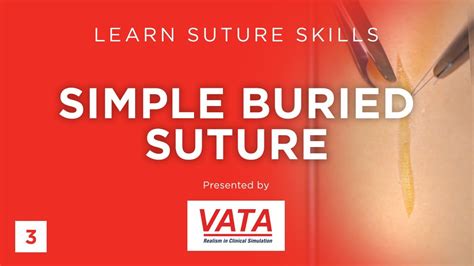 Simple Buried Suture Learn Suture Techniques Vata Youtube