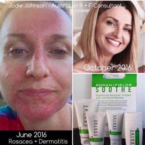 Rodan And Fields Soothesimply The Best Shrptsn Rodan And Fields