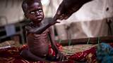 Children in need images pictures. Why are so many Africans hungry? (VIDEO) | Public Radio ...