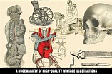 100 Vintage Medical Illustrations By Dene Studios | TheHungryJPEG