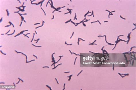 Bifidobacterium Bifidum Photos And Premium High Res Pictures Getty Images