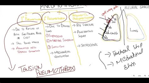 Pneumothorax Spontaneous Traumatic And Tension Pneumothorax Youtube