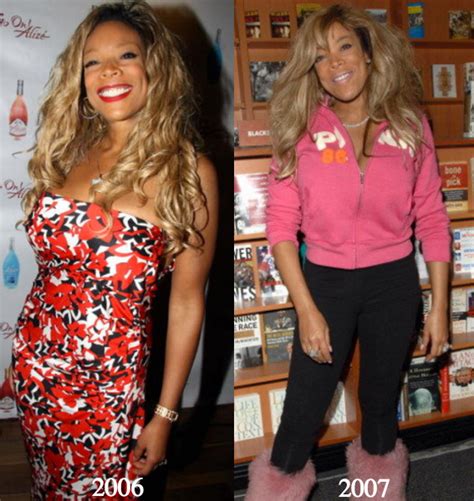 Wendy Williams Plastic Surgery Before And After Photos