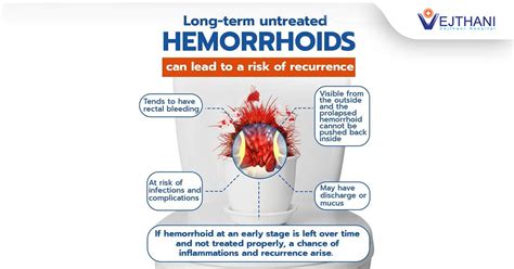 Long Term Untreated Hemorrhoids Can Lead To A Risk Of Recurrence