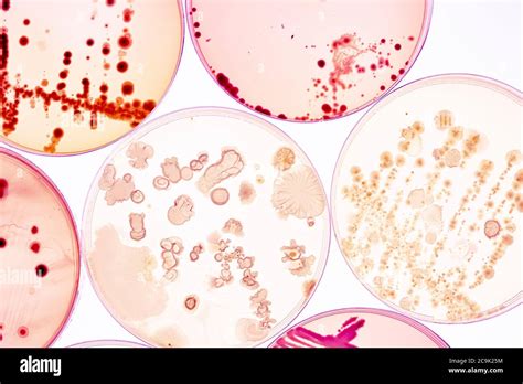 Bacterial Colonies On Agar Plates Stock Photo Alamy