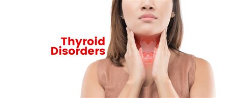 Thyroid Disorders Kdah Blog Health And Fitness Tips For Healthy Life