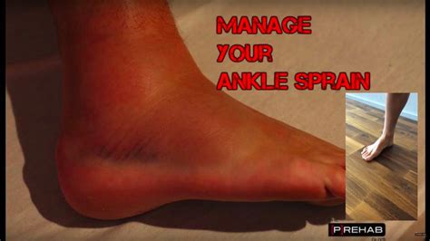 Did You Sprain Your Ankle Try This Program Ankle Sprain Program