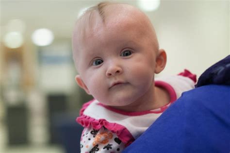 Rare Birth Defects Still Spiking In Washington State