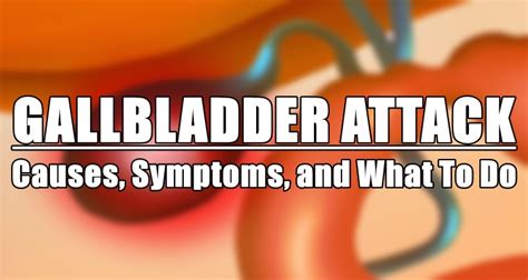 Gallbladder Attack Causes Symptoms And What To Do