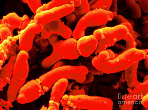 Bifidobacterium Breve Photograph By Scimat Pixels