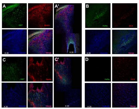 At One Month Post Tbi Confocal Microscopy Revealed A Surge Of
