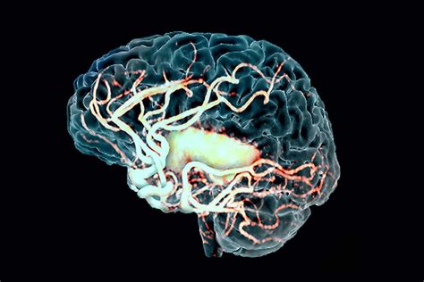 See Through Brains Reveal How Stroke Damages Vital Blood Vessels New Scientist