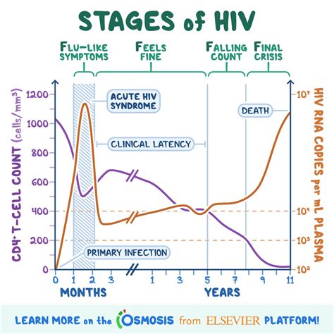 stages of aids