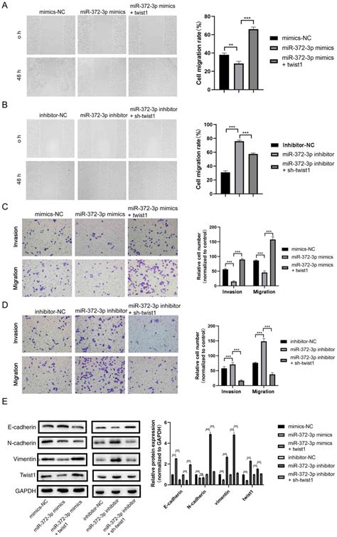 mir‑372‑3p promotes preeclampsia progression by regulating twist1