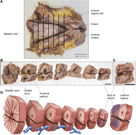 Panel A Shows A Photograph Of Female Cadaveric Pelvic Dissection With