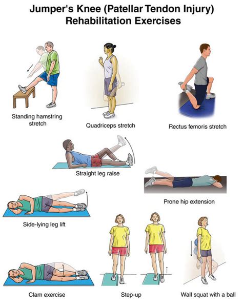 Patellar Tendinitis Causes Symptoms Stretching Exercises Treatments