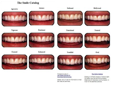 15 Best Dental Transformations Images On Pinterest Dental Dentistry