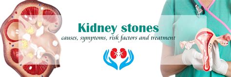 Kidney Stone Causes Symptoms Risk Factors And Treatment Kayawell