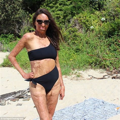 Turia Pitt Poses In A Bikini Before Covering Up In A Shirt Daily Mail Online