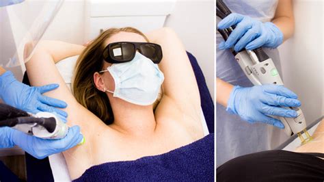 There are no studies that. 8 things you should know before having laser hair removal ...