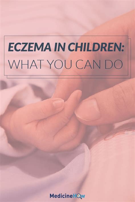 Atopic Eczema In Children Learn To Recognize The Signs And Treatment