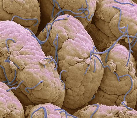 Threadworms In The Gut Sem Photograph By Science Photo Library