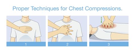 Cpr In The Adult Patient Medictests