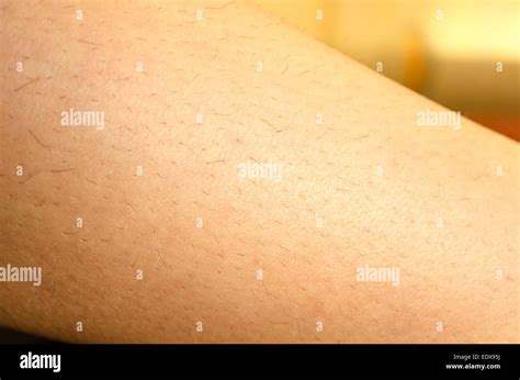 Laser Hair Bad Hi Res Stock Photography And Images Alamy
