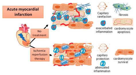 Ijms Free Full Text Evaluating Novel Targets Of Ischemia