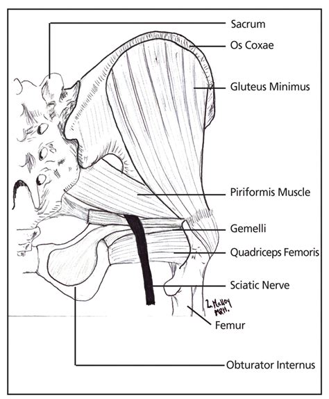 Diagnosis And Management Of Piriformis Syndrome An Osteopathic Approach